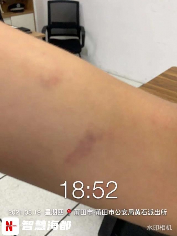 14岁男生遭9名同学围殴致脑震荡!有的竟是为了凑热闹