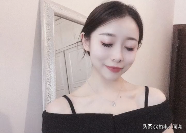 24岁女孩烧伤928天后重生!12次手术仍不放弃,向河南灾情捐500元