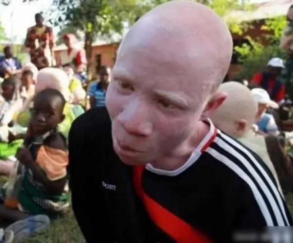 他们的皮肤却不像大多数非洲人一样,呈现黑色的状态,而是像白人一样