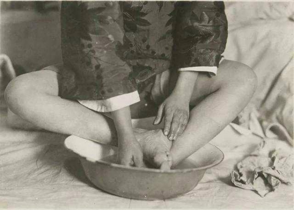 中国最后的小脚老人，三寸金莲只有丈夫见过，如今105几乎不洗脚