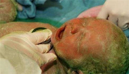 90后产妇怀孕35周被迫生产惊现变色娃娃医生看见都吓傻了4