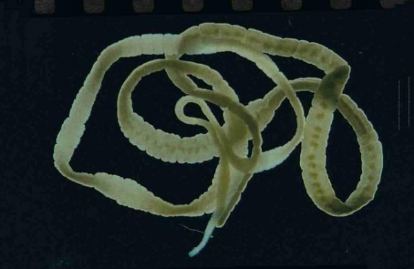 古代女人用生命爱美，吃虫减肥喝砒霜美白，突然感觉玻尿酸很好