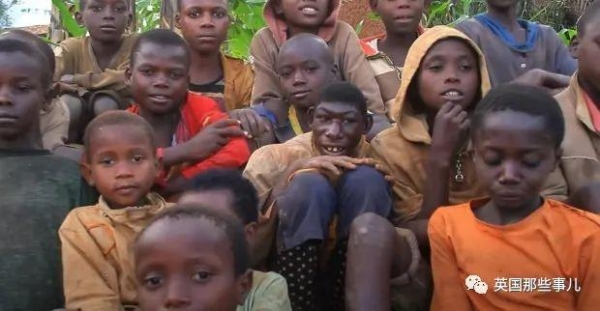 非洲男孩长相返祖只吃水果，被村民当