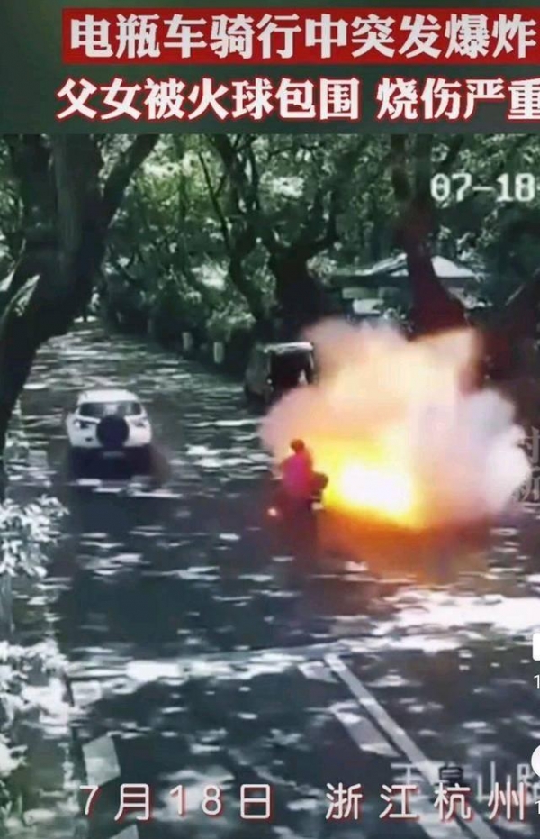 杭州电瓶车行驶中爆燃 7岁女孩被烧伤三次病危