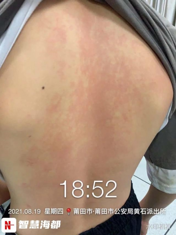 14岁男生遭9名同学围殴致脑震荡！有的竟是为了凑热闹