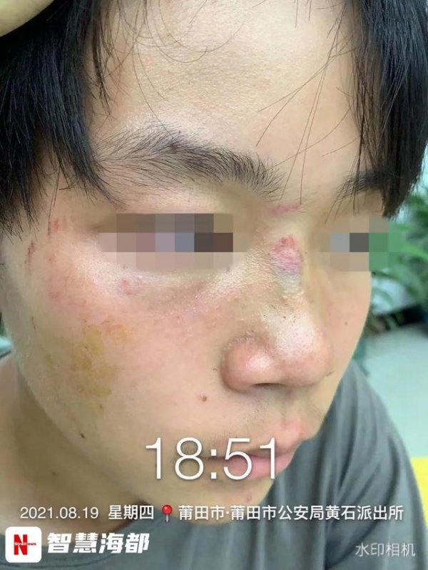 14岁男生遭9名同学围殴致脑震荡！有的竟是为了凑热闹