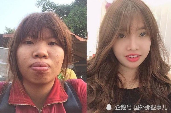 丑姑娘一直找不到对象,花8.5万整容后嫁给富二代,生完孩子后离婚