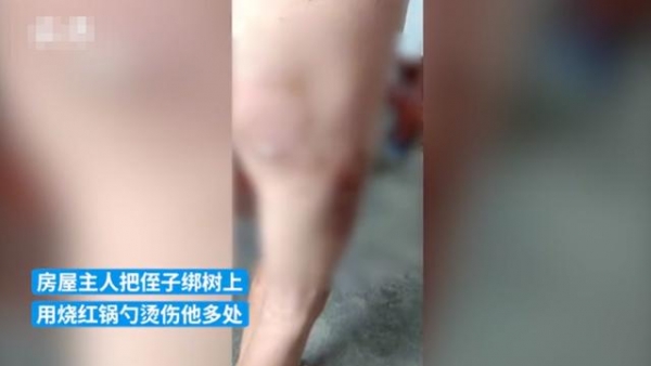 因进陌生人家偷拿饼干，广东8岁男童被房主绑在树上用高温锅勺烫伤！家属：低保家庭，孩子爸爸是精神病人
