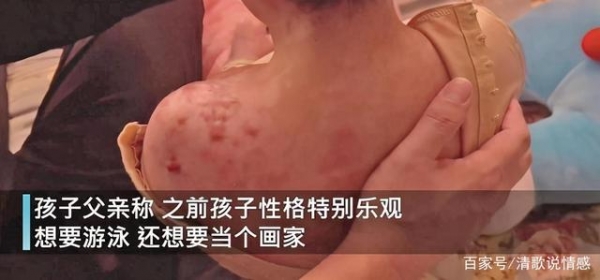 辽宁抚顺6岁女孩受虐案,有新进展