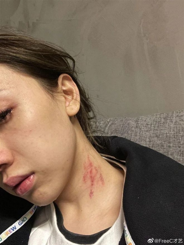 女歌手遭男友施暴往脸上吐口水正牌女友变pao友