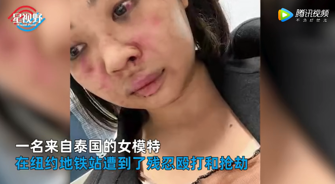 亚裔美女模特地铁站遭殴打猥亵鼻青脸肿满腿血污恶心一幕曝光