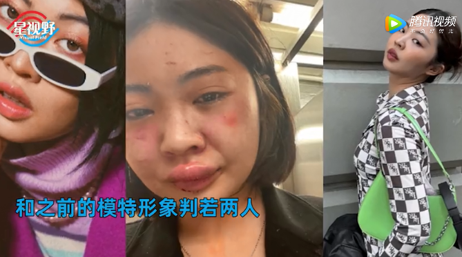 亚裔美女模特地铁站遭殴打猥亵鼻青脸肿满腿血污恶心一幕曝光