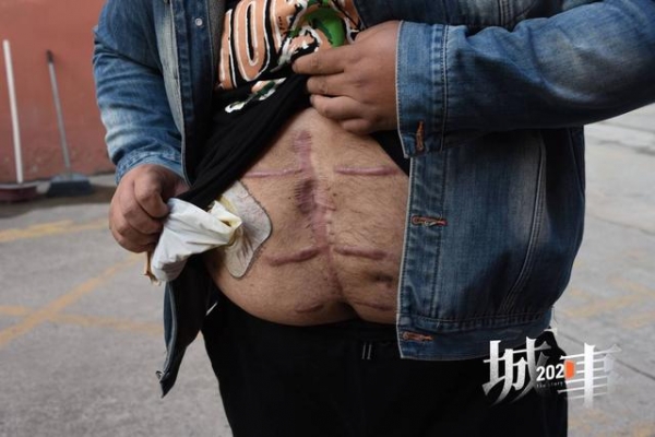对话“南京胖哥”：我不是英雄，受伤是因为自己能力不够，“南京胖哥”的名头是一种负担