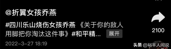 24岁女孩烧伤928天后重生！12次手术仍不放弃，向河南灾情捐500元
