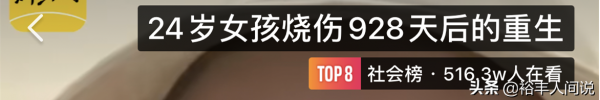 24岁女孩烧伤928天后重生！12次手术仍不放弃，向河南灾情捐500元