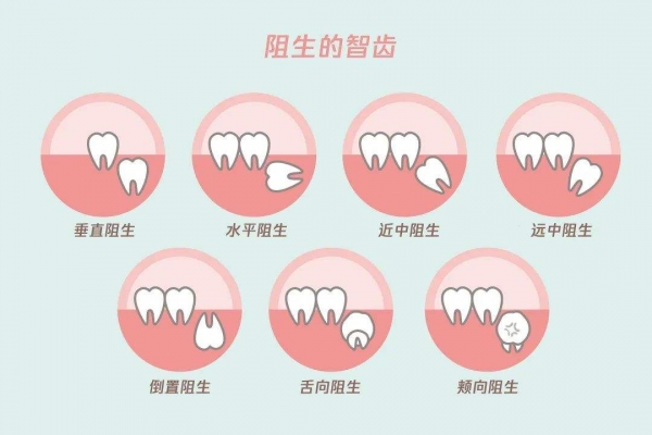 科学家发现人类的Y染色体正在不断缩短，未来的男性将何去何从？