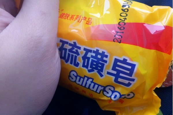 青岛一21岁女大学生用硫磺皂洗澡，坚持了半年，收获了什么？