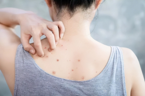 青岛一21岁女大学生用硫磺皂洗澡，坚持了半年，收获了什么？