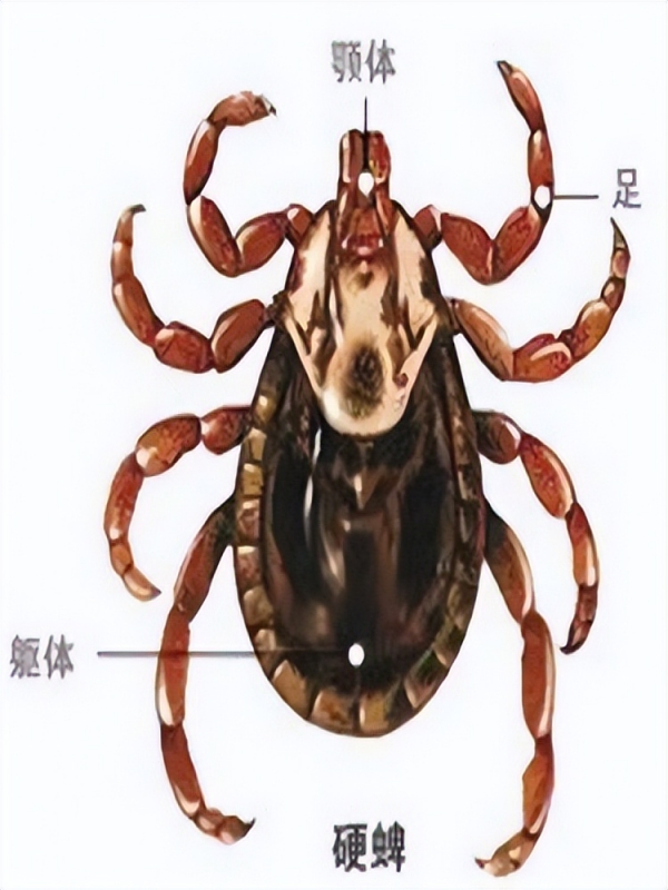 3人因蜱虫病去世,曾为去世感染者净身(2)