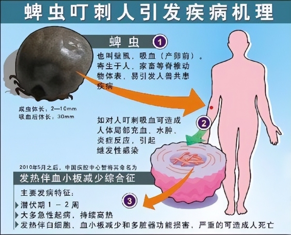 河南3名老人因蜱虫病病逝：曾接触去世感染者