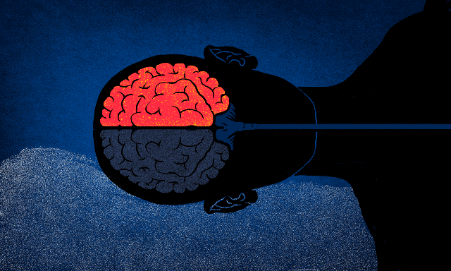 你经常硬扛的「偏头痛」，其实是第二大致残原因