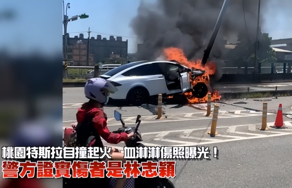 警方确认林志颖遭遇车祸，小儿子受伤照曝光，父子俩暂无生命危险