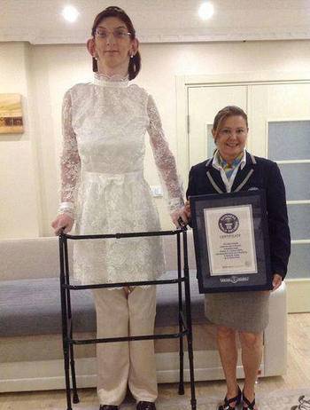 世界最高女孩身高2米13居然无法站立行走去