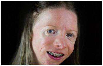 女子患无脸症做16次整形手术丈夫你是世界上最美的女人