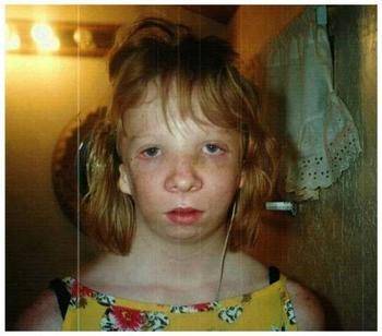 女子患无脸症做16次整形手术丈夫你是世界上最美的女人