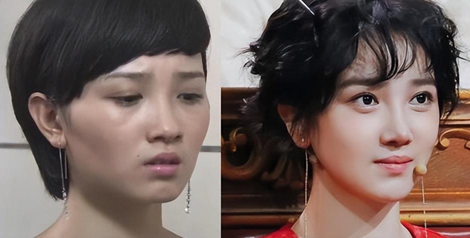 明明从大饼脸变小v脸,却死不承认整容?醒醒吧,已经被基因出卖