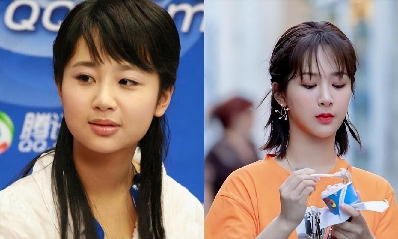 明明从大饼脸变小v脸,却死不承认整容?醒醒吧,已经被基因出卖