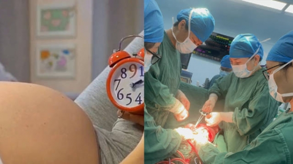 33岁女子剖宫产5胎后再生第6娃，出血1600ml，胎盘像“章鱼”