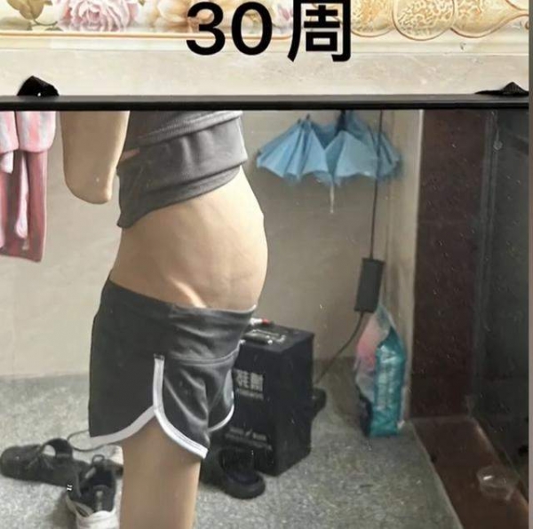 骨瘦如柴！女子身高1米6体重50斤仍减肥 自称只是喜欢骨感身材