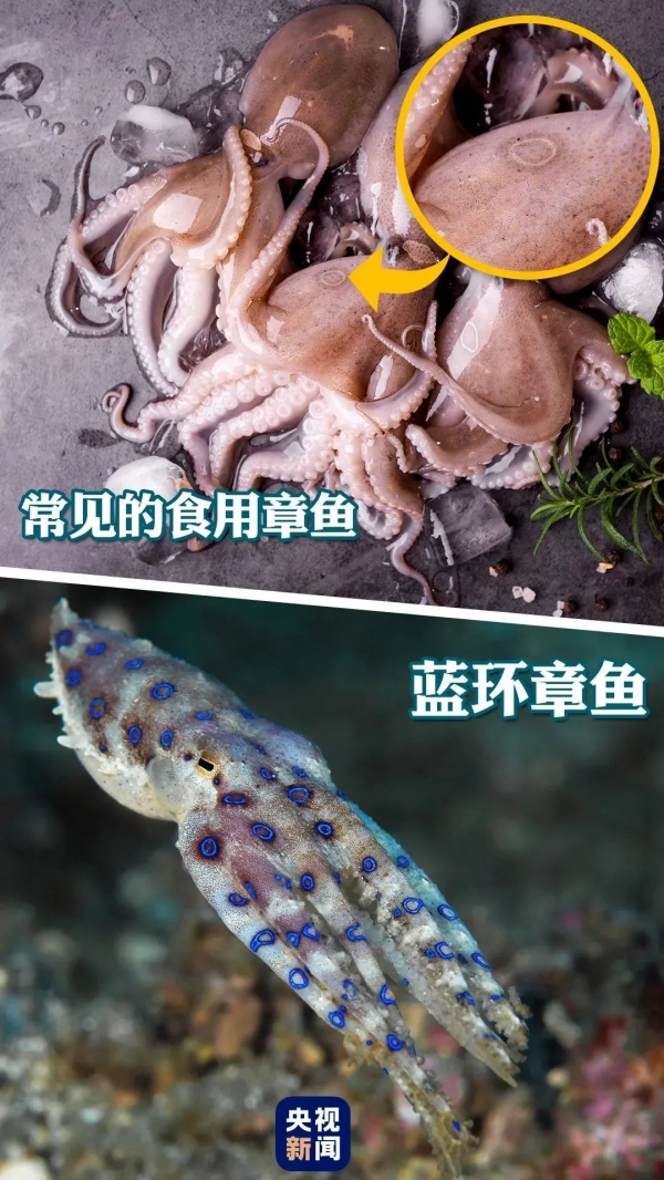 蚊子最喜欢这个血型的人？错！这几类人更容易招蚊子