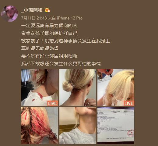 女网红被运动员男友家暴 在电梯打出满头血