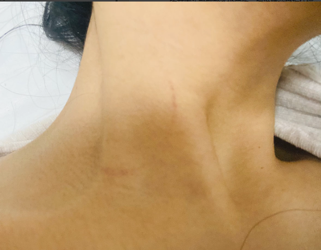 跆拳道男子侵犯女子未遂，对其一顿暴打