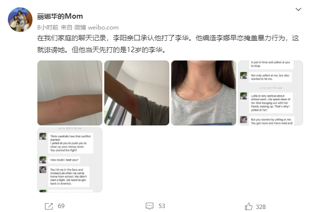 女儿伤痕照曝光 前妻斥李阳编造谎言掩盖暴力行为