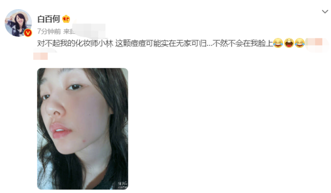 37岁白百何晒素颜怼脸自拍 脸上长痘十分显眼